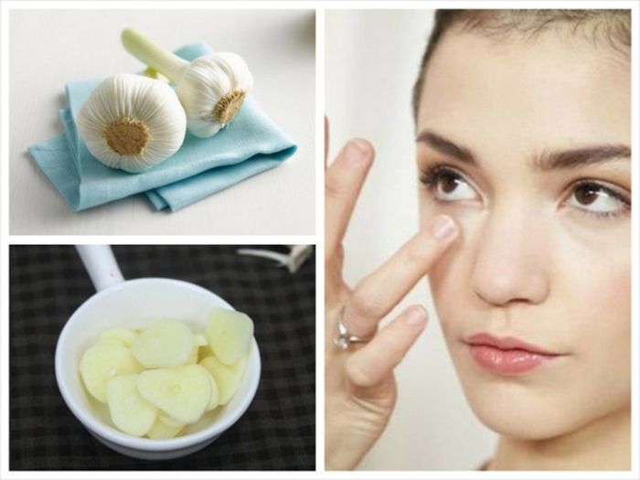Tổng hợp những cách làm mờ sẹo do mụn gây ra