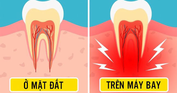 10 điều ‘kì lạ’ xảy ra với cơ thể khi đi máy bay, bạn cần nên biết