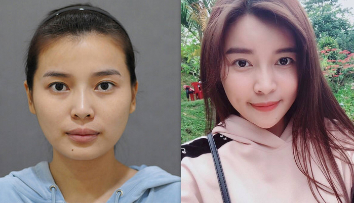 Cao Thái Hà bị đào mộ ảnh thời chưa thẩm mỹ