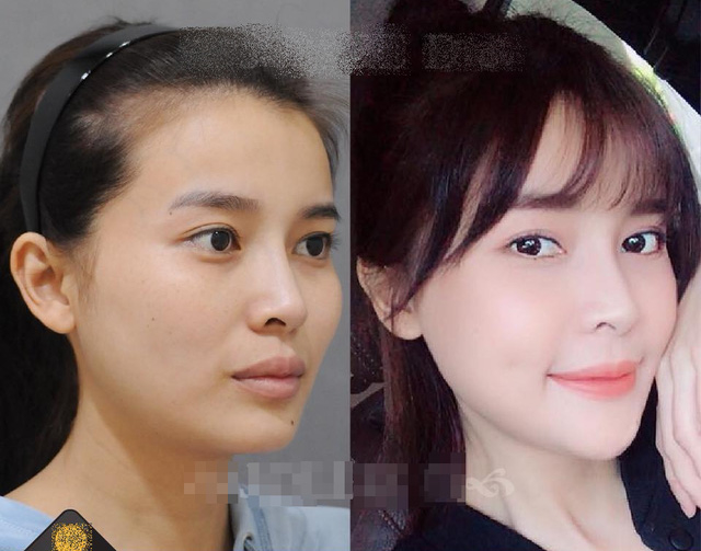 Cao Thái Hà bị đào mộ ảnh thời chưa thẩm mỹ