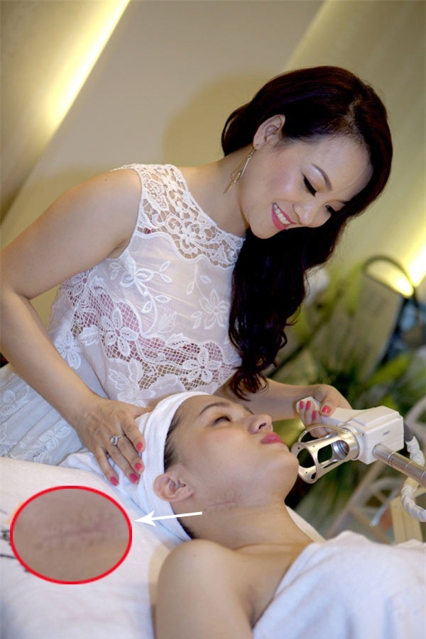 Đâu là “gót chân Achilles” của sao Việt?