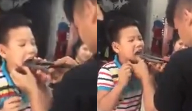 Dùng kìm tự nhổ răng cho con trai, ông bố bị dân mạng “ném đá”