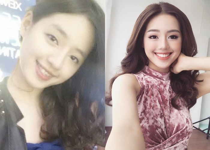 Loạt hot girl chứng minh mạnh dạn sửa sang nhan sắc thì sẽ xinh đẹp