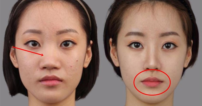 Nhân tướng học: Phẫu thuật thẩm mỹ có ảnh hưởng đến vận mệnh?