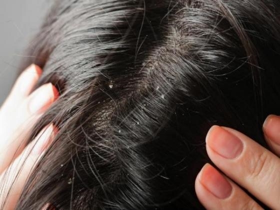 Những công dụng tuyệt vời của nước súc miệng (Phần 1)