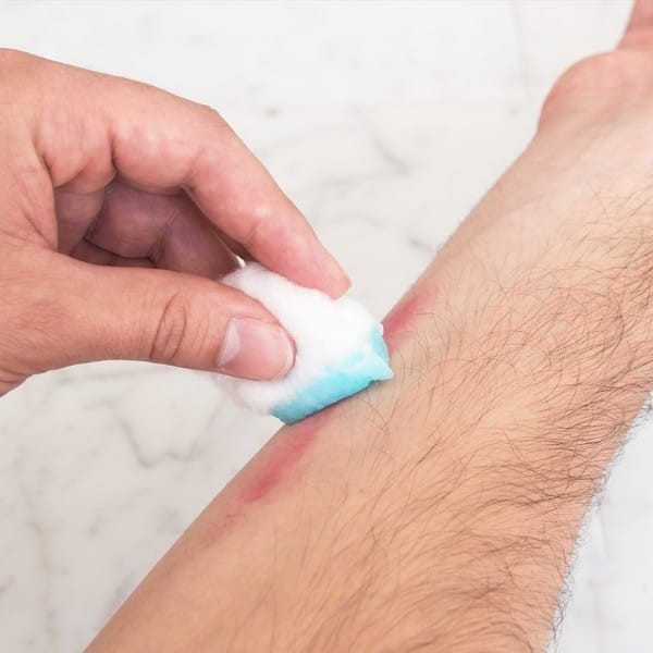 Những công dụng tuyệt vời của nước súc miệng (Phần 1)