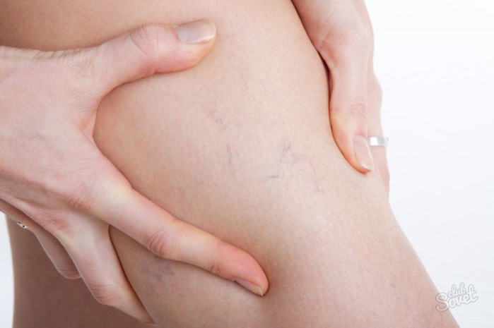 Những điều sẽ xảy ra nếu ngày nào bạn cũng ngồi một chỗ 8 giờ đồng hồ
