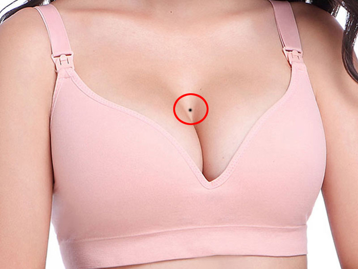 Nốt ruồi ở 8 vị trí hiểm trên cơ thể phái nữ báo hiệu sự giàu sang