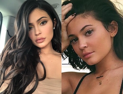 “Nữ hoàng môi tều” Kylie Jenner giờ môi đã xẹp lép, sao Việt thì sao?