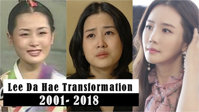 Park Min Young va hung sao duoc xem la cuc pham nganh tham my Han