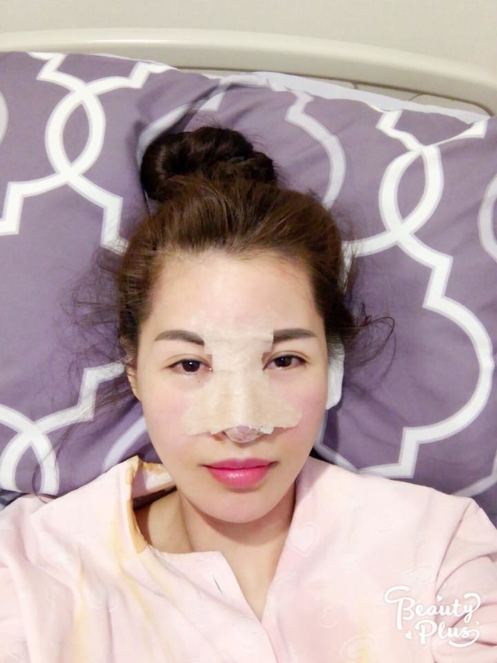 Thay vì giấu giếm, đây là những sao Việt tự tin khoe chuyện dao kéo