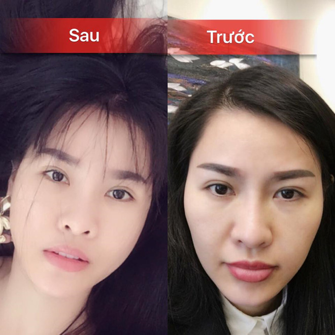 Thay vì giấu giếm, đây là những sao Việt tự tin khoe chuyện dao kéo