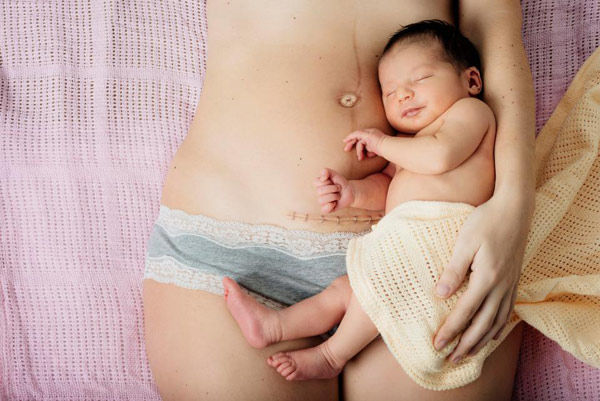 Tìm đáp án cho câu hỏi của không ít bà mẹ: sinh thường hay mổ tốt hơn?