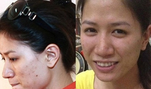 Những căn bệnh nghề nghiệp sao Việt phải chịu đựng
