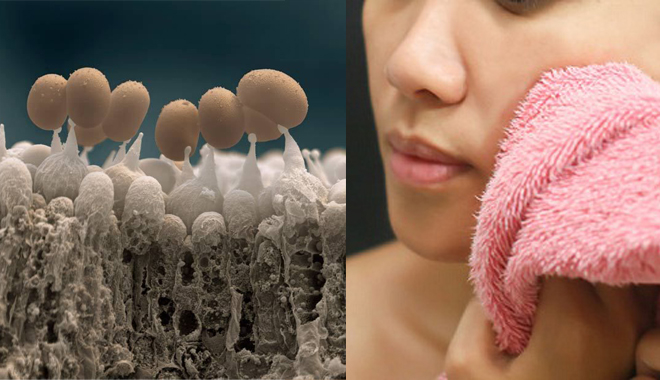 8 kẻ thù kề bên khiến da xấu và dễ nổi mụn mà chúng ta thường lơ là