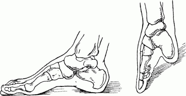 Chân gót sen và cái giá quá đắt để trả cho “cái đẹp”