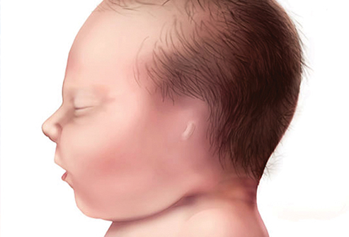 Chuyên gia mách bạn cách nhìn tai đoán bệnh “chuẩn không cần chỉnh”
