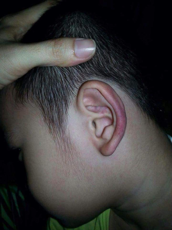 Chuyên gia mách bạn cách nhìn tai đoán bệnh “chuẩn không cần chỉnh”