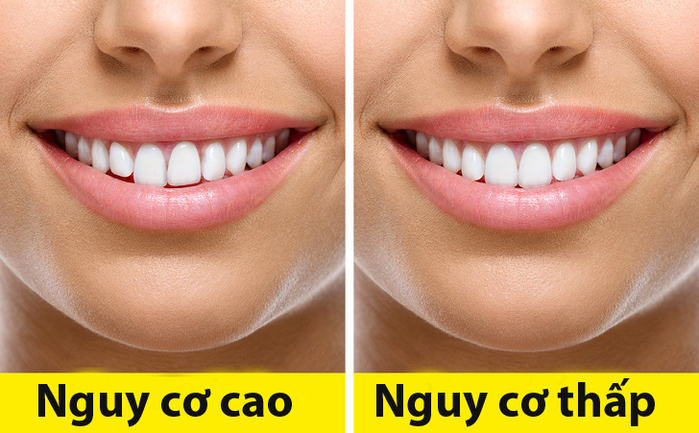 Chuyên gia tiết lộ những nguyên nhân khiến da mặt ngày càng chảy xệ