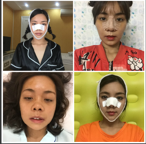 Cuộc sống của những cô gái sau khi PTTM