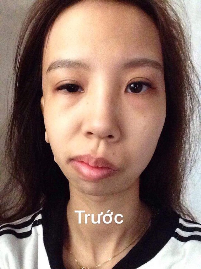 Cuộc sống của những cô gái sau khi PTTM