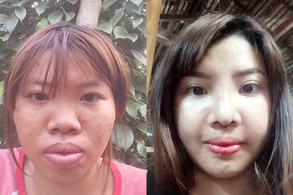 Cuộc sống của những cô gái sau khi PTTM