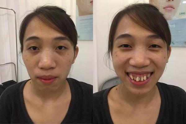 Cuộc sống của những cô gái sau khi PTTM