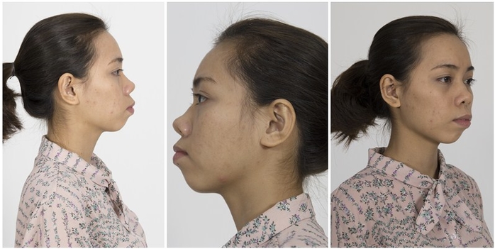 Cuộc sống của những cô gái sau khi PTTM