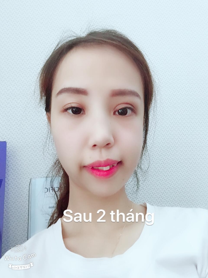 Cuộc sống của những cô gái sau khi PTTM