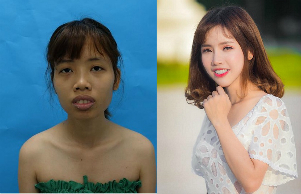 Cuộc sống của những cô gái sau khi PTTM