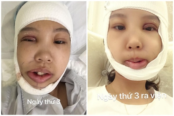 Cuộc sống của những cô gái sau khi PTTM