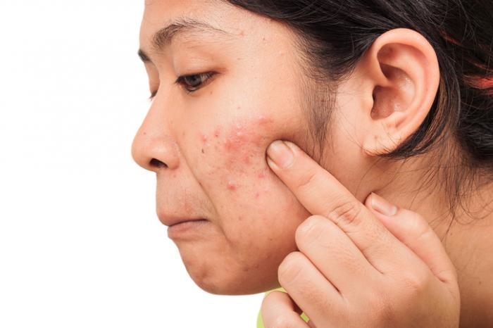 Bất chấp thời tiết mưa gió, làn da bạn vẫn đẹp rạng ngời