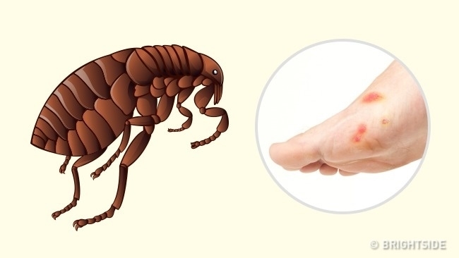 Nhận dạng vết cắn côn trùng nhanh chóng và cách giải quyết