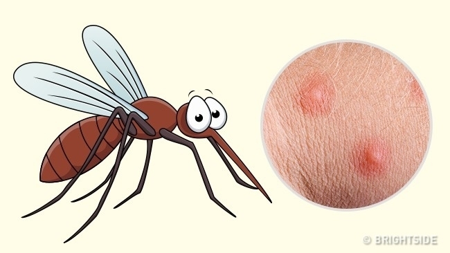 Nhận dạng vết cắn côn trùng nhanh chóng và cách giải quyết