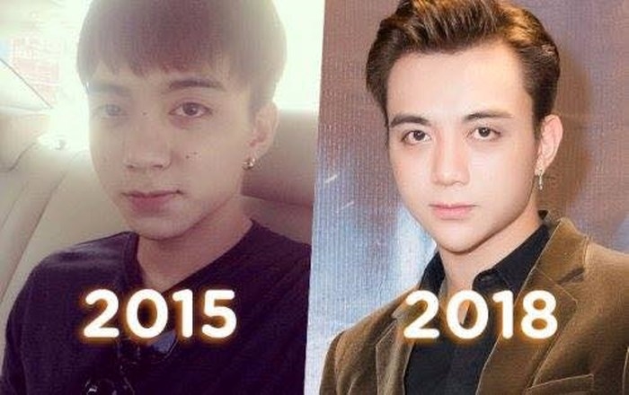 Diện mạo khác lạ của sao nam châu Á sau khi PTTM