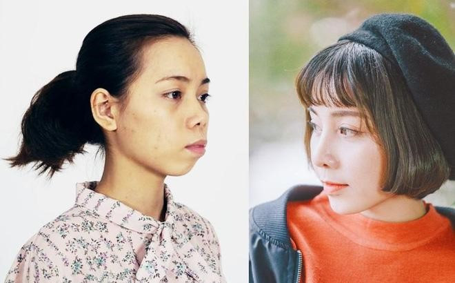 Hậu dao kéo, những cô gái từng bị chê xấu xí bậy giờ ra sao?
