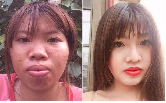 Hậu dao kéo, những cô gái từng bị chê xấu xí bậy giờ ra sao?