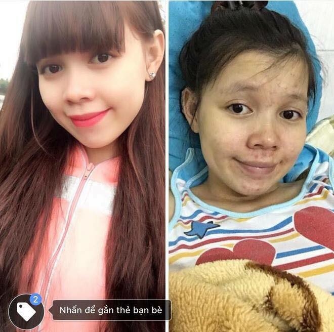 Loat anh truoc va khi mang thai cua chi em moi thay phu nu hi sinh nhu the nao