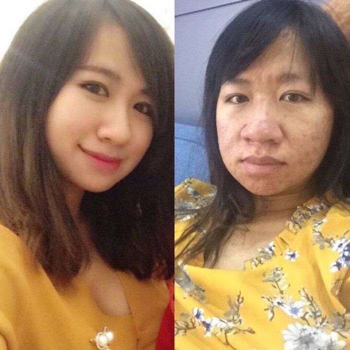 Loat anh truoc va khi mang thai cua chi em moi thay phu nu hi sinh nhu the nao