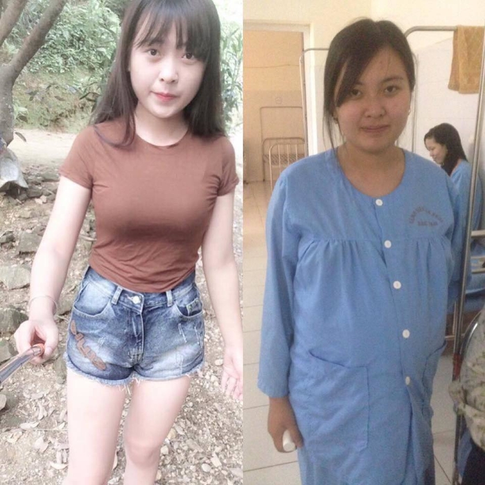 Loat anh truoc va khi mang thai cua chi em moi thay phu nu hi sinh nhu the nao