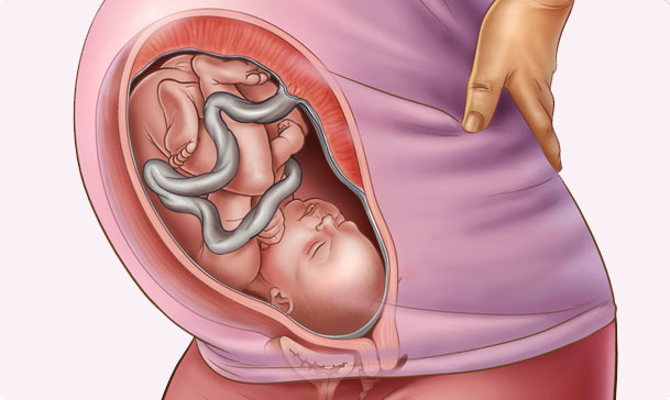 Mẹ bầu siêu âm nhiều có ảnh hưởng đến thai nhi không?