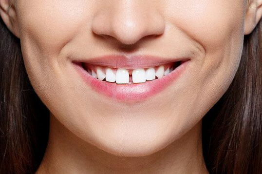 Nhìn tướng răng cũng có thể đoán biết chính xác vận mệnh giàu nghèo!