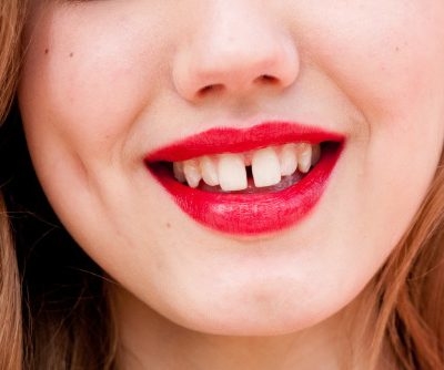 Nhìn tướng răng cũng có thể đoán biết chính xác vận mệnh giàu nghèo!
