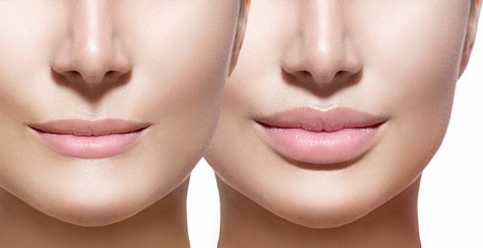 Những bộ phận không ngờ có thể phẫu thuật thẩm mỹ