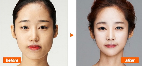 Những bộ phận không ngờ có thể phẫu thuật thẩm mỹ