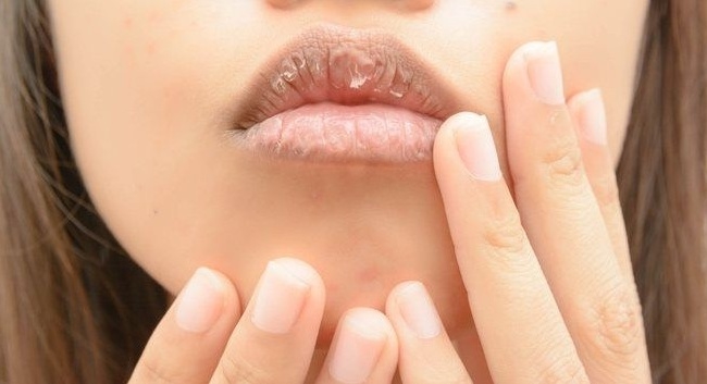 Những dấu hiệu bất thường trên cơ thể giúp bạn phát hiện bệnh sớm hơn