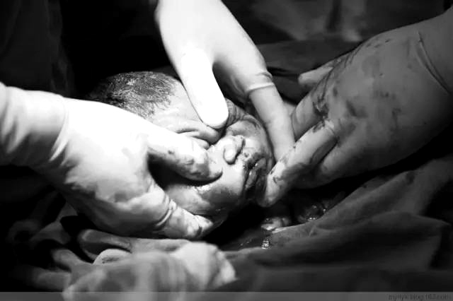 Nỗi khổ của phụ nữ khi phải trải qua ca sinh mổ