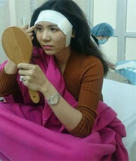 Những bộ phận không ngờ có thể phẫu thuật thẩm mỹ