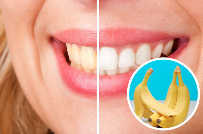 13 mẹo vặt nhỏ nhưng có võ cứu nguy chị em trong cuộc sống