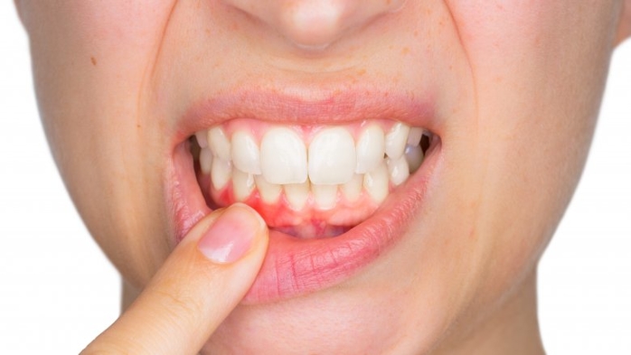 4 dấu hiệu bạn hoàn toàn có thể biết cơ thể đang có vấn đề